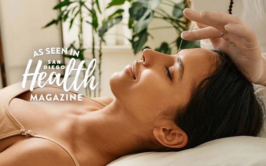 A woman rests comfortably as an acupuncture provider presses a needle into her forehead to relieve migraine pain. SD Health Magazine