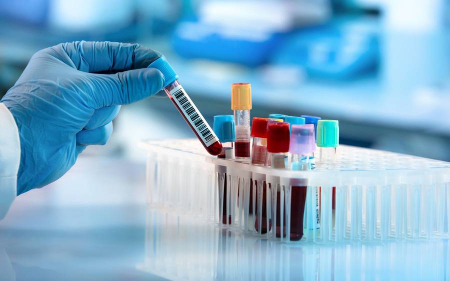 Vials of blood drawn from a patient will be tested as part of routine blood work.