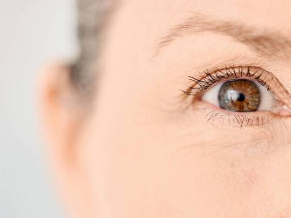 A woman with eye floaters.