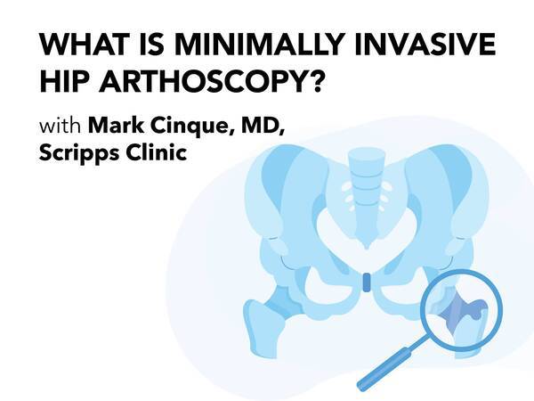 Thumbnail for video podcast featuring Dr. Cinque, orthopedics, discussing hip arthroscopy surgery.