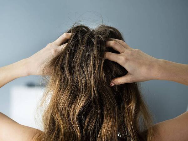 A woman scratches an itch on her scalp, unaware of what could be causing it.