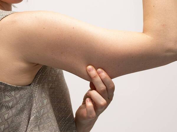 A woman with saggy skin.