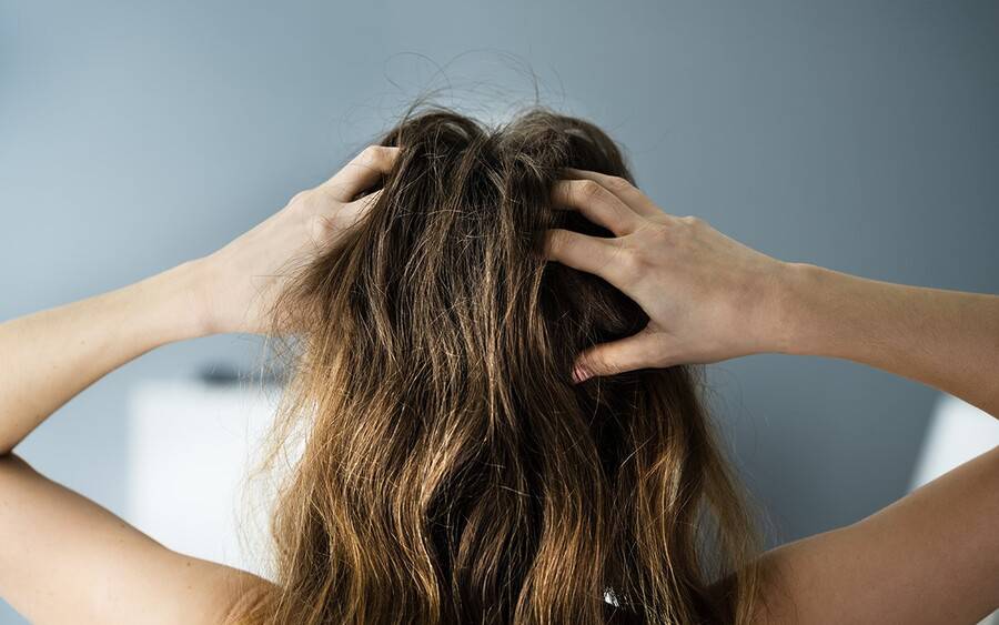 A woman scratches an itch on her scalp, unaware of what could be causing it.
