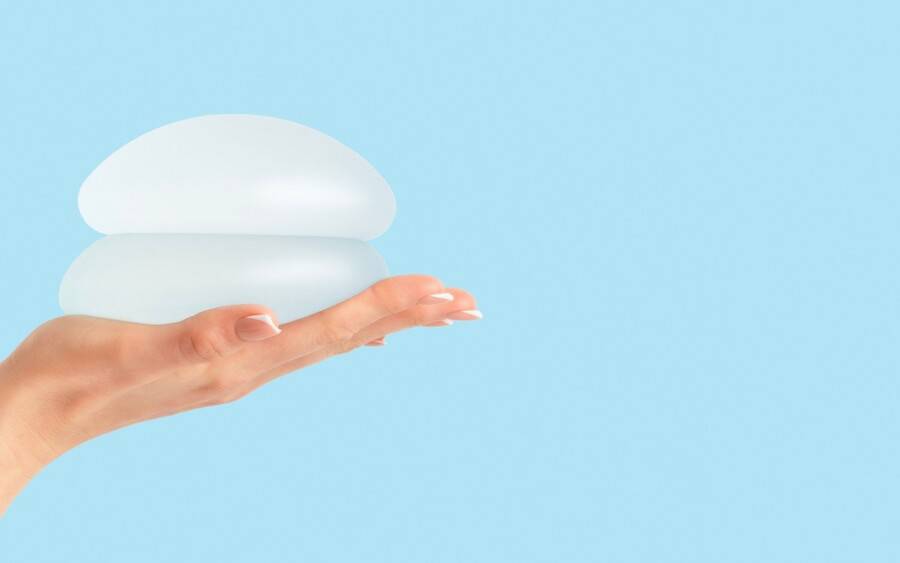 A woman holds breast implants, illustration for mammograms and breast implants.