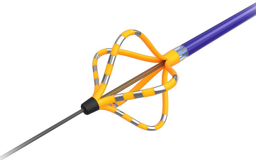 An image of a newly approved device that treats irregular heartbeat, which a Scripps physician was first to use in SD county.