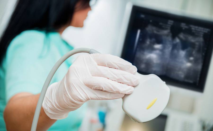 An ultrasound technician holds the device transducer in a gloved hand, representing the highly skilled radiology experts at Scripps.